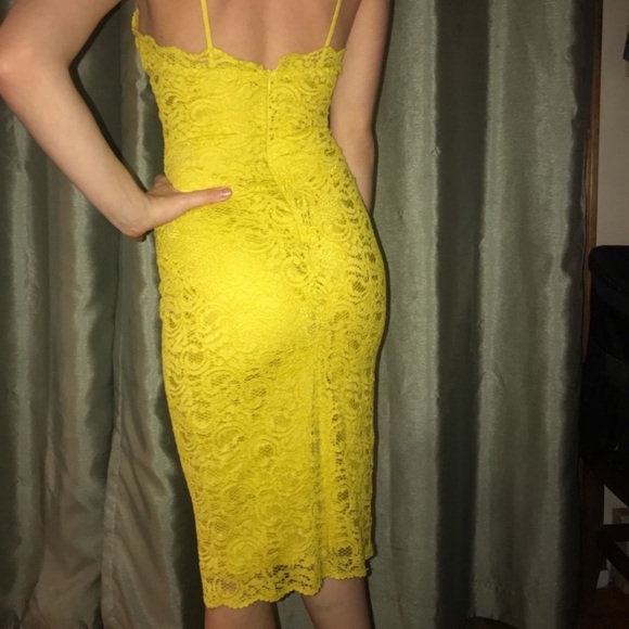 Zara Yellow Lace Overlay Dress - Picture 12 of 15